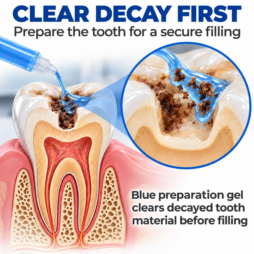 Dr.Fachmer® DentRestore Tooth Repair & Filling System 🌷