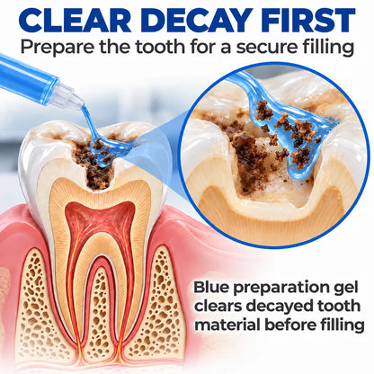 Dr.Fachmer® DentRestore Tooth Repair & Filling System 🌷