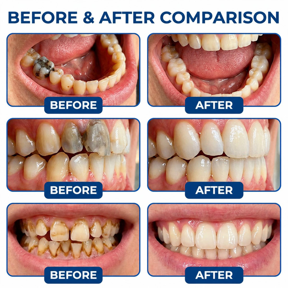 Dr.Fachmer® DentRestore Tooth Repair & Filling System 🌻