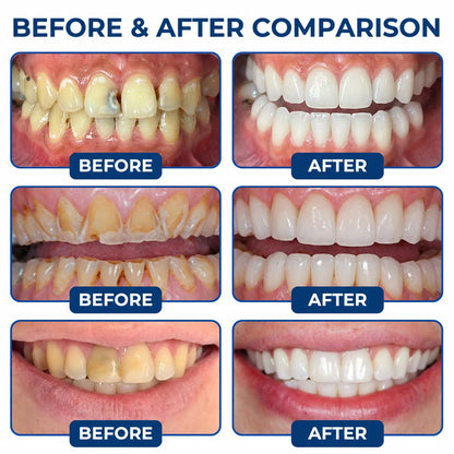 Dr.Fachmer® DentRestore Tooth Repair & Filling System 🌳